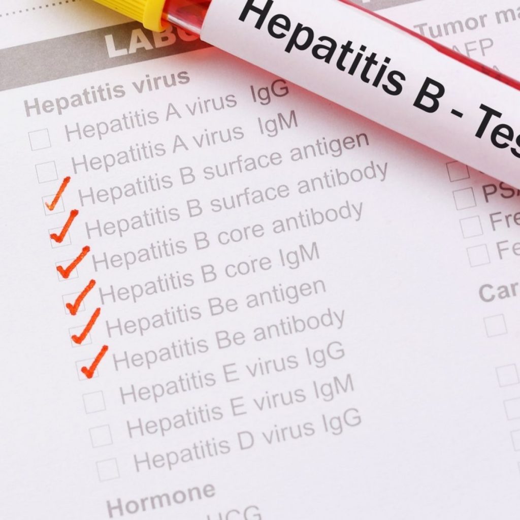 Hepatitis B test