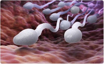 Seminal Fluid Analysis (SFA): Good Sperm Qualities