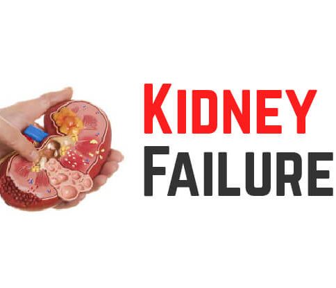 Chronic Kidney Disease (CKD): Causes, Symptoms, Prevention