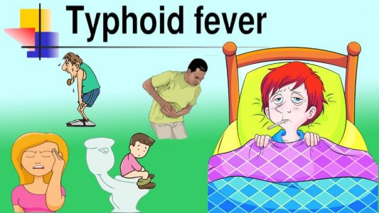 Typhoid Fever: Causes, Symptoms, Treatment