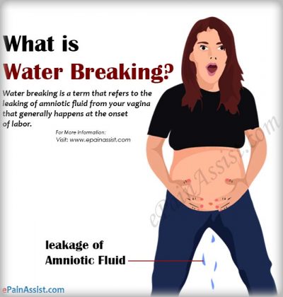 Water Breaking in Pregnancy: What it Means